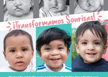 ANTAPACCAY IMPULSA CAMPAÑA GRATUITA PARA PACIENTES CON LABIO LEPORINO Y PALADAR HENDIDO DE ESPINAR