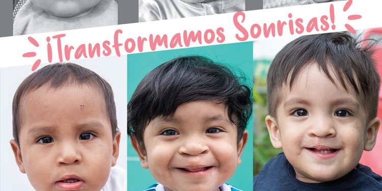 ANTAPACCAY IMPULSA CAMPAÑA GRATUITA PARA PACIENTES CON LABIO LEPORINO Y PALADAR HENDIDO DE ESPINAR