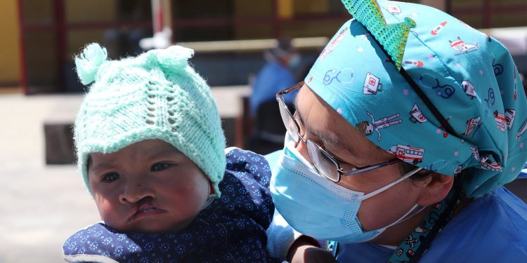 PACIENTES CON LABIO LEPORINO Y PALADAR HENDIDO FUERON EVALUADOS POR ESPECIALISTAS DE OPERACIÓN SONRISA Y ANTAPACCAY